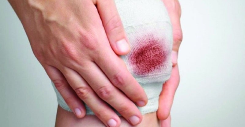 mo-thay-bi-chay-mau-2